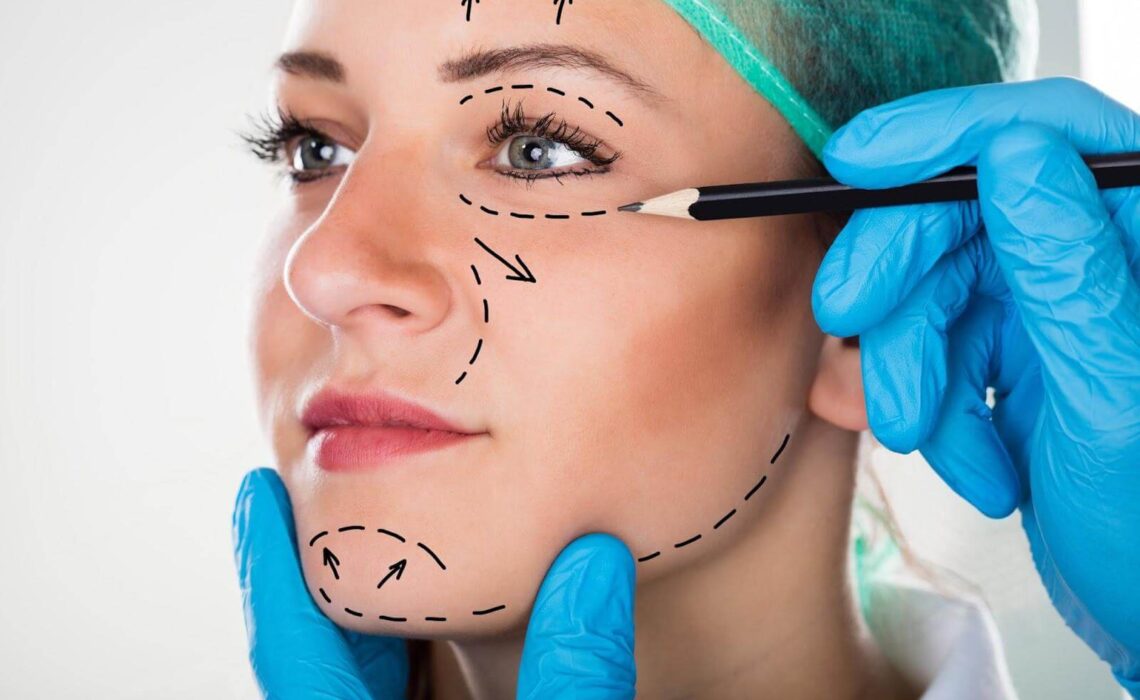 How Long Does a Facelift Last on Average? | Suntrics