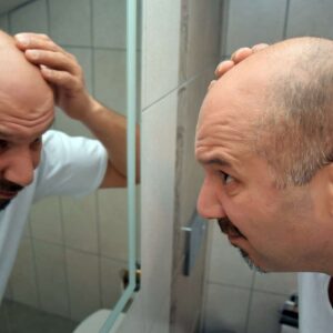Early Signs Of Hair Loss