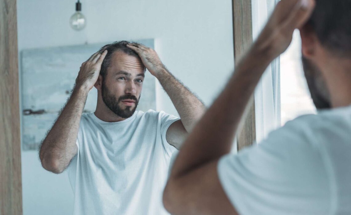 The Hair Transplant Cost Guide: What To Expect In A Hair Transplant