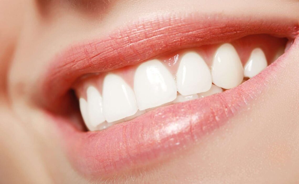 How To Make Teeth Alignment Fashionable