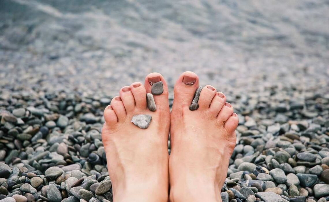 Walking Away From The Pain: How To Treat Bunions