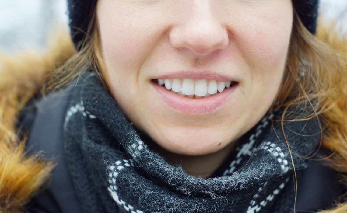 How To Get Whiter Teeth
