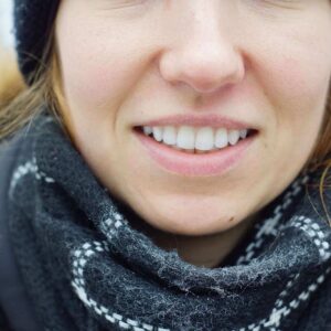 How To Get Whiter Teeth
