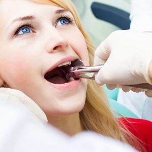 Prepare For Wisdom Teeth Removal