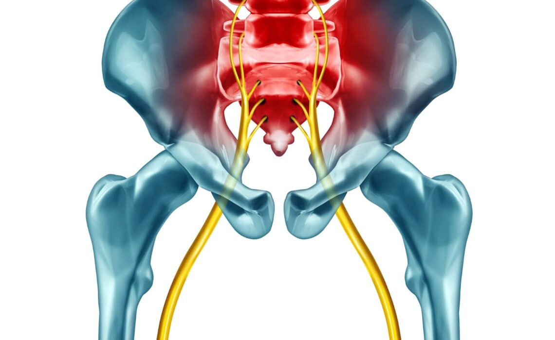 What Is Sciatica Surgery And How Does It Work?