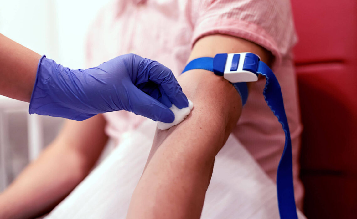 How To Find A Vein To Draw Blood Painlessly