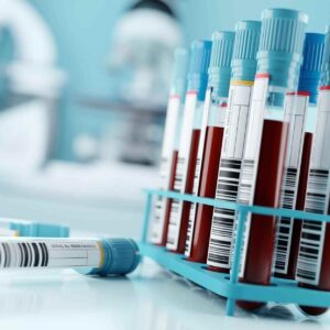 Benefits Of At-Home Blood Testing