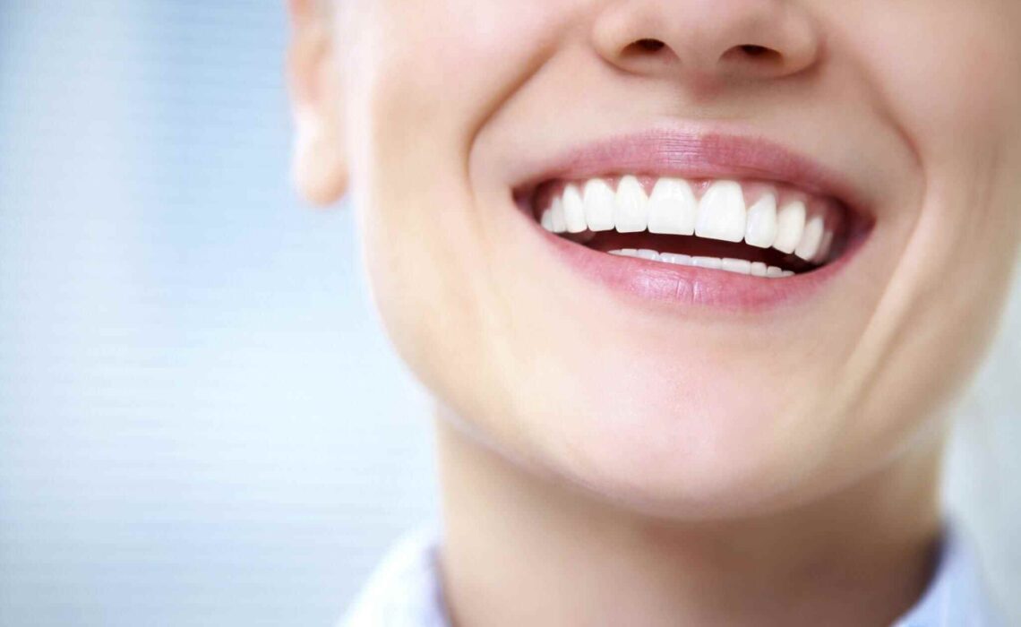 Holistic Teeth Whitening Houston: Unveiling The Secrets To A Brighter Smile