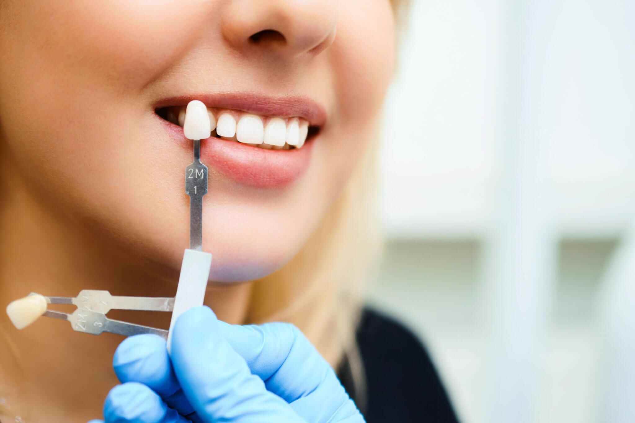 Transforming Oral Health With Dental Implants