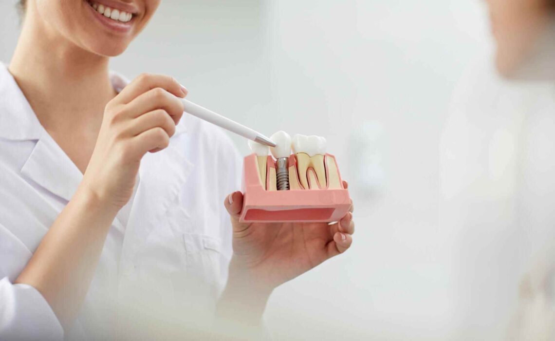 Restoring Your Smile With Dental Implants In San Antonio