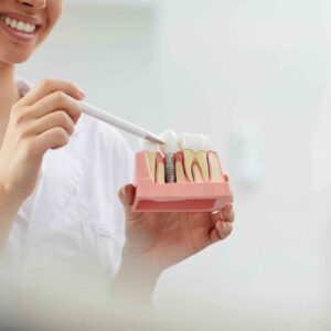 Smile With Dental Implants