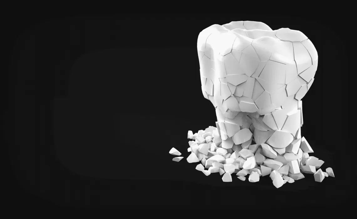 Hairline Tooth Fracture