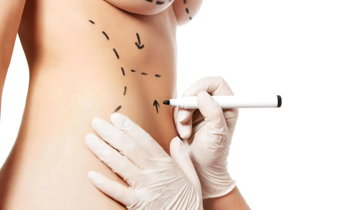 Benefits Of Non-Invasive Body Contouring