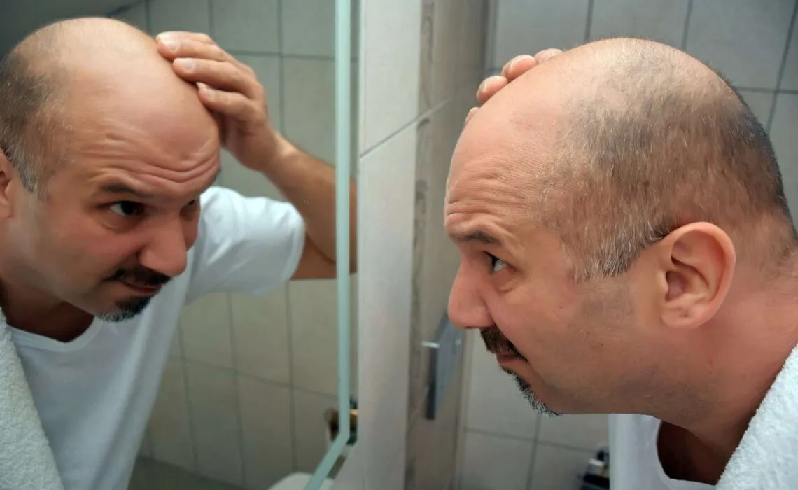 Early Signs Of Hair Loss