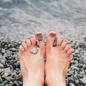 How To Treat Bunions