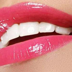 Need To Do To Get A Bright Smile