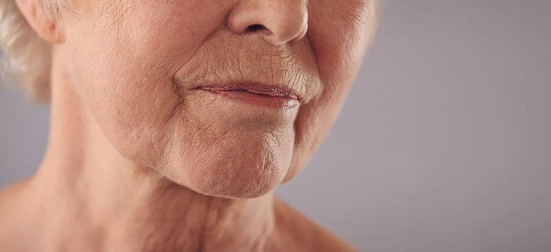 How To Reduce Neck Wrinkles