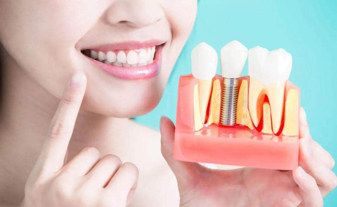Dental Implant Procedure