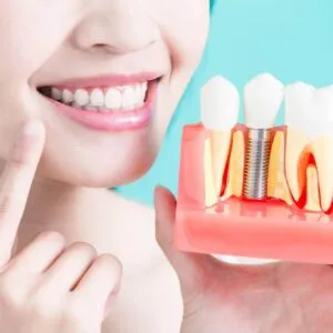 Dental Implant Procedure