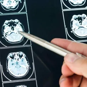 TBI Victim Should Take