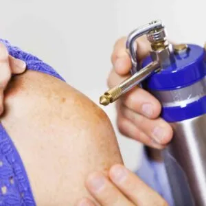 What Is Cryosurgery