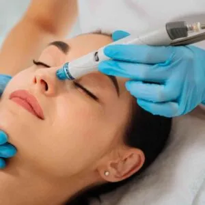 Should Try A Hydrafacial
