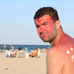 Dangers Of UV Radiation