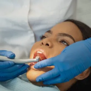 Root Canal Treatment